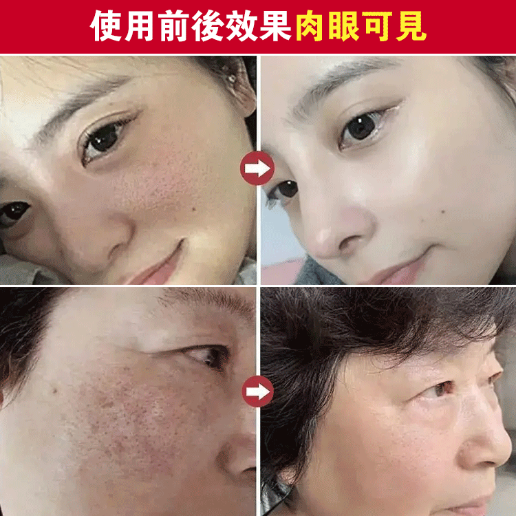 【毛孔縮縮】淨顏固體面膜    毛孔“吸麈器”,黑頭清道夫 【毛孔縮縮】淨顏固體面膜    毛孔“吸麈器”,黑頭清道夫